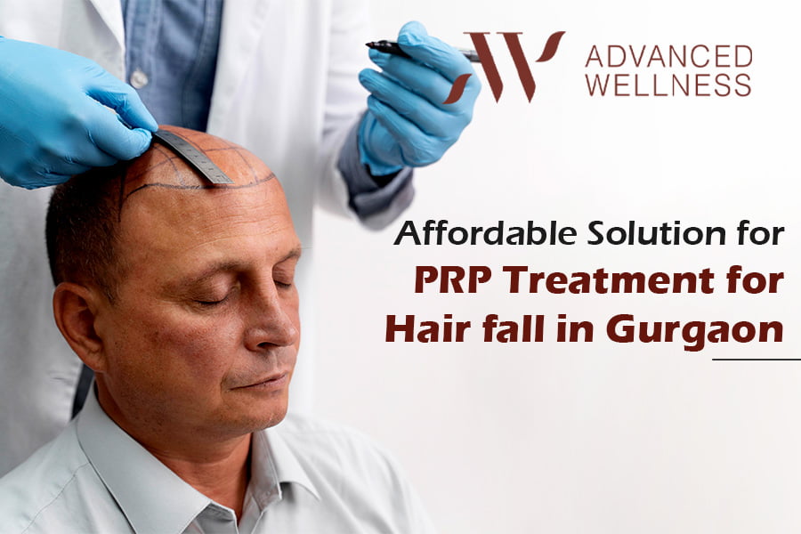 You are currently viewing Affordable Solution for PRP Treatment for Hair Fall in Gurgaon