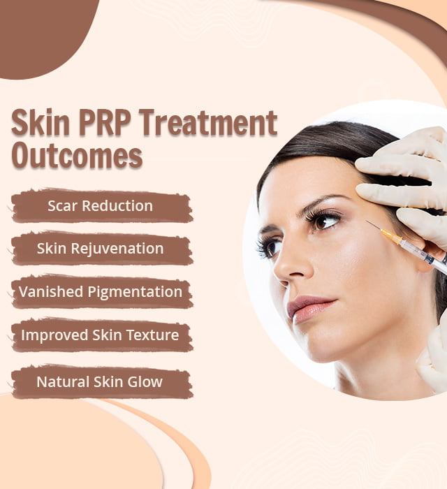 PRP Treatment For Skin Outcomes